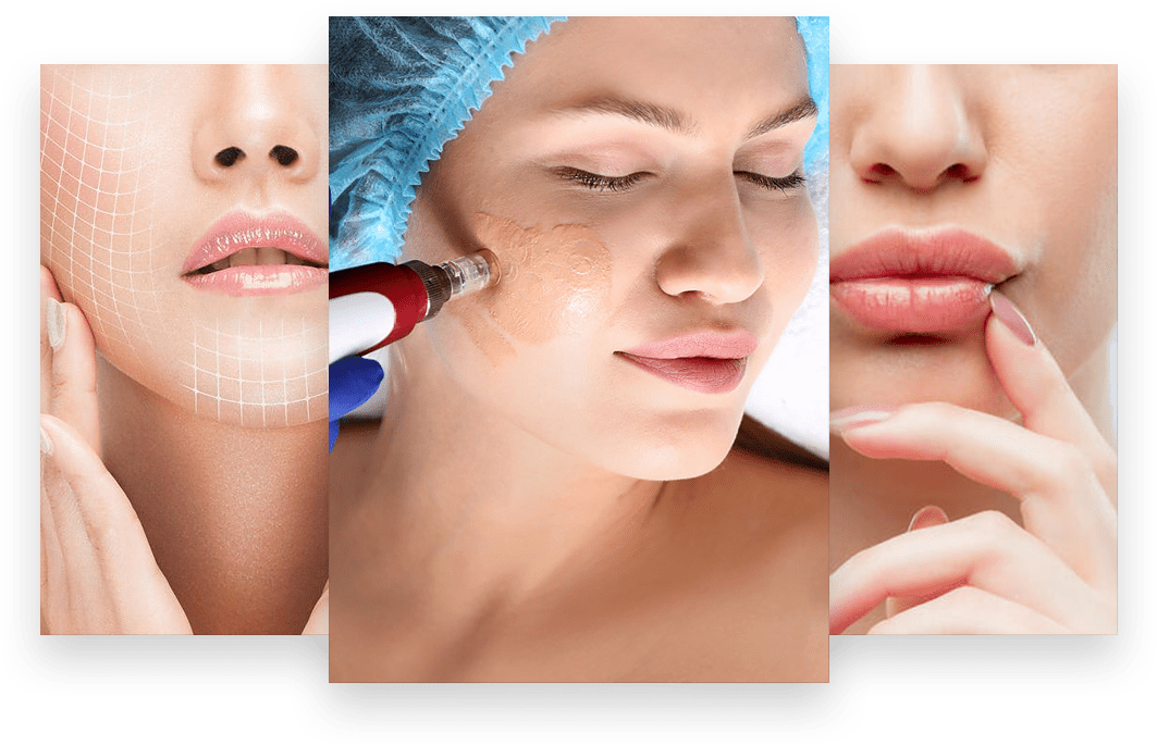 curso bbglow dermapen bblips