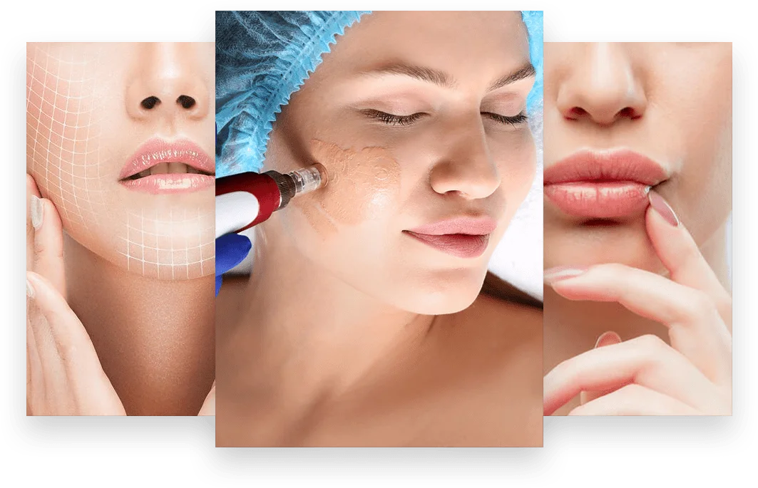 curso bbglow dermapen bblips