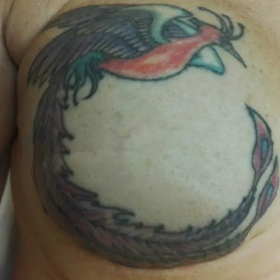 Tatuaje de Reconstrucción Complejo Areola-Pezón Tatuaje de Reconstrucción Complejo Areola-Pezón