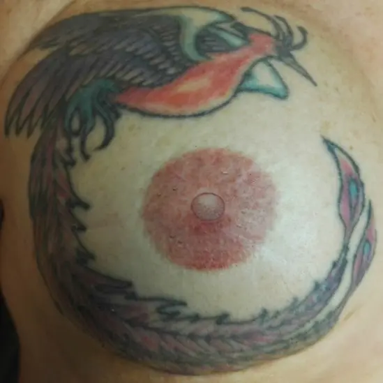 Tatuaje de Reconstrucción Complejo Areola-Pezón (2) Tatuaje de Reconstrucción Complejo Areola-Pezón