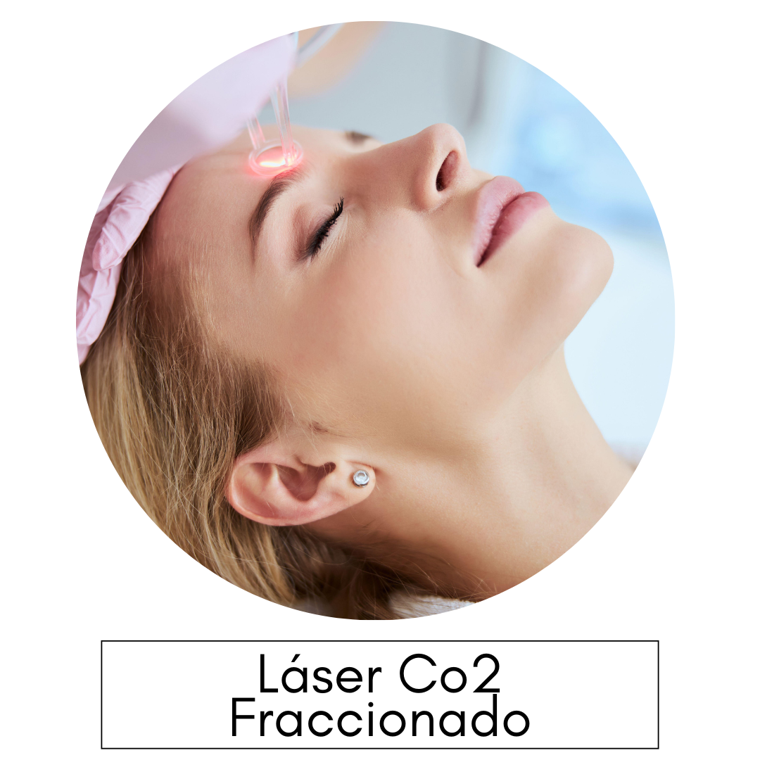 laser co2 fraccionado montevideo